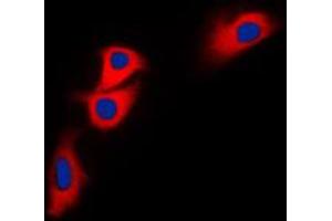 Immunofluorescent analysis of BNIP2 staining in HEK293T cells. (BNIP2 antibody  (C-Term))