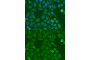 Immunofluorescence analysis of A549 cells using SSX5 antibody.