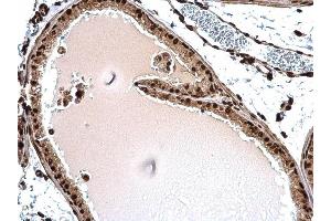 IHC-P Image Histone H1. (Histone H1.3 antibody  (Center))