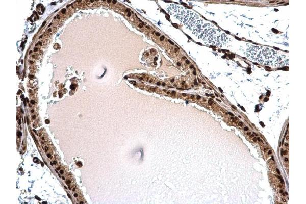 Histone H1.3 antibody  (Center)