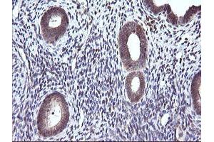 Image no. 6 for anti-Cancer/testis Antigen 1B (CTAG1B) antibody (ABIN1499894) (CTAG1B antibody)