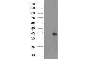 Western Blotting (WB) image for anti-Haloacid Dehalogenase-Like Hydrolase Domain Containing 2 (HDHD2) antibody (ABIN1498627) (HDHD2 antibody)