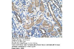 Rabbit Anti-CYP2D6 Antibody  Paraffin Embedded Tissue: Human Kidney Cellular Data: Epithelial cells of renal tubule Antibody Concentration: 4.