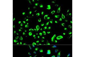 Immunofluorescence analysis of HeLa cells using YWHAQ Polyclonal Antibody (14-3-3 theta antibody)