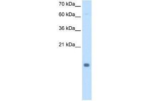 WB Suggested Anti-CSTB Antibody Titration:  0. (CSTB antibody  (N-Term))