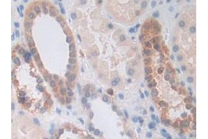 DAB staining on IHC-P; Samples: Human Kidney Tissue (PPIF antibody  (AA 45-196))