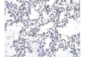 Rabbit Anti-SMAD4 antibody        Paraffin Embedded Tissue:  Human Lung cell   Cellular Data:  Epithelial cells of renal tubule  Antibody Concentration:   4. (SMAD4 antibody  (N-Term))