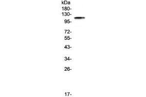 Western Blotting (WB) image for anti-PMS2 Postmeiotic Segregation Increased 2 (S. Cerevisiae) (PMS2) (AA 656-767) antibody (ABIN5708101)