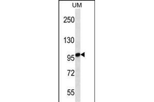 STIM2 Antibody (N-term) (ABIN656476 and ABIN2845756) western blot analysis in uterus tumor cell line lysates (35 μg/lane). (Stim2 antibody  (N-Term))