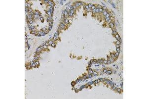 Immunohistochemistry of paraffin-embedded human prostate using EFNA1 Antibody. (Ephrin A1 antibody)