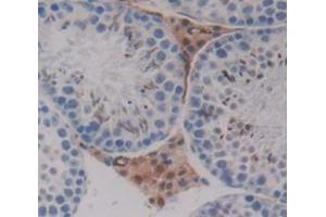 Used in DAB staining on fromalin fixed paraffin- embedded Kidney tissue (PPHLN1 antibody  (AA 1-381))