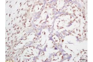 Formalin-fixed and paraffin embedded mouse embryo labeled with Anti-HDAC11 Polyclonal Antibody, Unconjugated  at 1:200 followed by conjugation to the secondary antibody and DAB staining. (HDAC11 antibody  (AA 21-120))