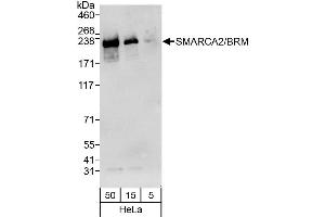 Western Blotting (WB) image for anti-SWI/SNF Related, Matrix Associated, Actin Dependent Regulator of Chromatin, Subfamily A, Member 2 (SMARCA2) (AA 1325-1375) antibody (ABIN7452046)