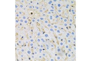 Immunohistochemistry of paraffin-embedded mouse liver using Tau antibody (ABIN3021441, ABIN3021442, ABIN3021443 and ABIN6215045) at dilution of 1:100 (40x lens). (MAPT antibody  (AA 1-100))