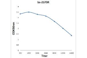 Antigen: 0. (FABP5 antibody  (AA 21-120))