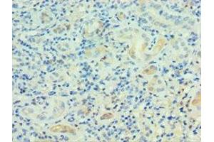 Immunohistochemistry of paraffin-embedded human kidney tissue using ABIN7164230 at dilution of 1:100 (PSG1 antibody  (AA 180-419))