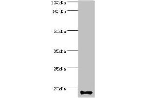 Western blot All lanes: Calmodulin-like protein 5 antibody at 12 μg/mL + A431 whole cell lysate Secondary Goat polyclonal to rabbit IgG at 1/10000 dilution Predicted band size: 16 kDa Observed band size: 16 kDa (CALML5 antibody  (AA 1-146))