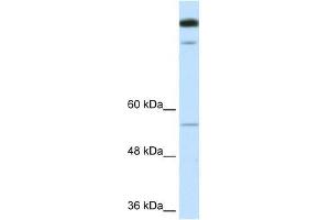 TIMELESS antibody used at 1.