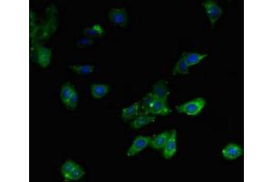 Immunofluorescent analysis of HepG2 cells using ABIN7158953 at dilution of 1:100 and Alexa Fluor 488-congugated AffiniPure Goat Anti-Rabbit IgG(H+L) (MLYCD antibody  (AA 40-493))