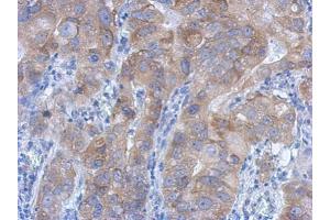 Immunohistochemistry (IHC) image for anti-Inhibitor of kappa Light Polypeptide Gene Enhancer in B-Cells, Kinase beta (IKBKB) (C-Term) antibody (ABIN2856162)