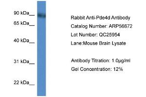 WB Suggested Anti-Pde4d  Antibody Titration: 0. (PDE4D antibody  (N-Term))
