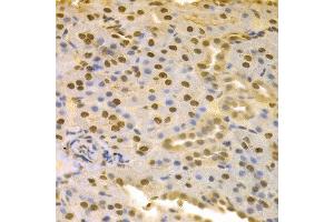 Immunohistochemistry of paraffin-embedded rat kidney using COPS5 antibody at dilution of 1:100 (x400 lens).