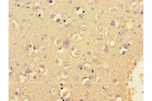 Immunohistochemistry of paraffin-embedded human brain tissue using ABIN7157745 at dilution of 1:100