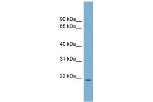 WB Suggested Anti-CUTA Antibody Titration:  0. (CUTA antibody  (Middle Region))