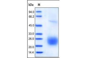 Human CTLA-4, His Tag on SDS-PAGE under reducing (R) condition. (CTLA4 Protein (AA 37-162) (His tag))