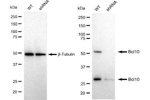 Western blotting analysis using Bcl10 antibody (ABIN7797717). (Recombinant BCL10 antibody)