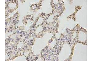 Immunohistochemistry (IHC) image for anti-Calcium/calmodulin-Dependent Protein Kinase IV (CAMK4) antibody (ABIN1876492) (CAMK4 antibody)