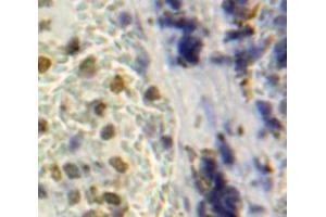 Used in DAB staining on fromalin fixed paraffin-embedded Spleen tissue (NUP160 antibody  (AA 1211-1436))