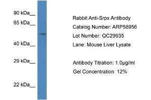 Western Blotting (WB) image for anti-Sushi-Repeat Containing Protein, X-Linked (SRPX) (C-Term) antibody (ABIN2787892)