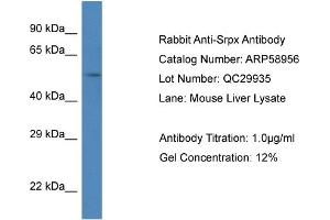 Western Blotting (WB) image for anti-Sushi-Repeat Containing Protein, X-Linked (SRPX) (C-Term) antibody (ABIN786020) (SRPX antibody  (C-Term))