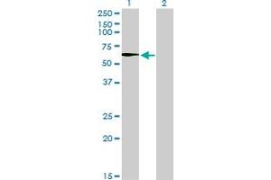 Western Blot analysis of STK33 expression in transfected 293T cell line by STK33 monoclonal antibody (M02), clone 6G1. (STK33 antibody  (AA 1-514))