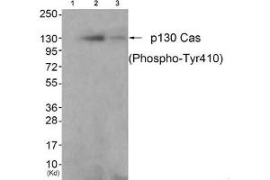 Western blot analysis of extracts from K562 cells (Lane 2) and 3T3 cells (Lane 3), using P130 Cas(Phospho-Tyr410) Antibody. (BCAR1 antibody  (pTyr410))