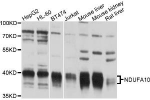 Western blot analysis of extracts of various cell lines, using NDUFA10 antibody (ABIN6003821) at 1/1000 dilution.