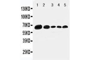 Anti-Paxillin antibody, Western blotting Lane 1: 293T Cell Lysate Lane 2: HELA Cell Lysate Lane 3: MCF-7 Cell Lysate Lane 4: MM231 Cell Lysate Lane 5: JUKAT Cell Lysate (Paxillin antibody  (C-Term))