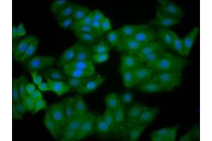 Immunofluorescence staining of HepG2 cells with ABIN7167158 at 1:166, counter-stained with DAPI. (IQGAP2 antibody  (AA 1245-1395))