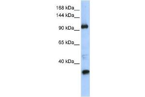 Western Blot showing TUT1 antibody used at a concentration of 1-2 ug/ml to detect its target protein. (TUT1 antibody  (Middle Region))
