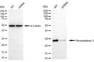 Western blotting analysis using Peroxiredoxin 3 antibody (ABIN7799778). (Recombinant Peroxiredoxin 3 antibody)
