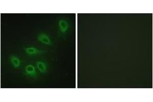 Immunofluorescence analysis of HeLa cells, using eNOS (Ab-1179) Antibody. (ENOS antibody  (AA 1145-1194))