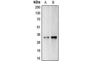 Western blot analysis of Carbonic Anhydrase 14 expression in A375 (A), Jurkat (B) whole cell lysates.