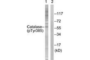 Western blot analysis of extracts from Jurkat cells, using Catalase (Phospho-Tyr385) Antibody. (Catalase antibody  (pTyr385))