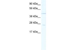 WB Suggested Anti-HOXB13 Antibody Titration:  1. (HOXB13 antibody  (Middle Region))