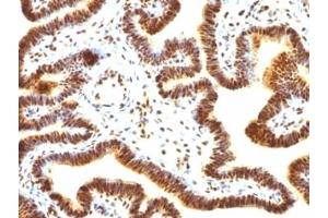 Immunohistochemistry (Formalin-fixed Paraffin-embedded Sections) (IHC (fp)) image for anti-Small Ubiquitin Related Modifier Protein 1 (SUMO1) antibody (ABIN3026864)