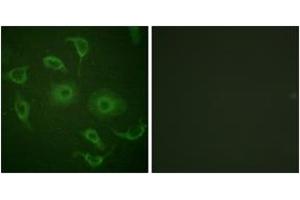 Immunofluorescence analysis of HepG2 cells, using Interferon-alpha/beta Receptor alpha chain (Ab-466) Antibody. (IFNAR1 antibody  (AA 436-485))