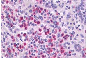 Anti-P2RY4 / P2Y4 antibody  ABIN1049219 IHC staining of human spleen. (P2RY4 antibody  (Extracellular Domain))
