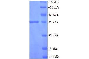 SDS-PAGE (SDS) image for Interferon, alpha 1 (IFNA1) (AA 24-189) protein (His-SUMO Tag) (ABIN5711119) (IFNA1 Protein (AA 24-189) (His-SUMO Tag))