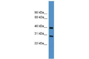 WB Suggested Anti-TIMP2 Antibody Titration: 0. (TIMP2 antibody  (Middle Region))